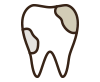 歯が痛い・しみる虫歯治療
