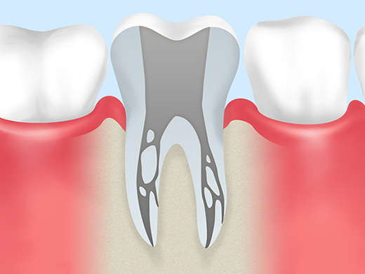 歯根は歯の土台です
